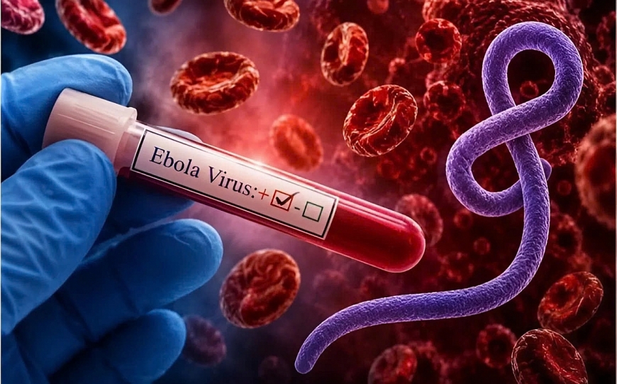 Bộ Y tế cập nhật vaccine phòng Ebola trong hướng dẫn chẩn đoán, điều trị mới