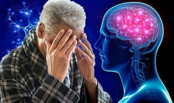 Người cao tuổi cần biết: Tổng quan về bệnh sa sút trí tuệ