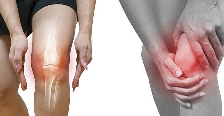7 cách chữa đau khớp gối ở người già hiệu quả