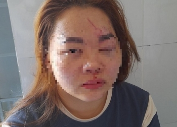 Kỷ luật thầy giáo ở Đắk Lắk đánh đập vợ nhập viện