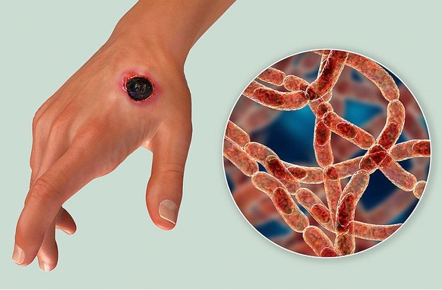 Mô phỏng vi khuẩn Bacillus anthracis gây bệnh than. Ảnh: Internet