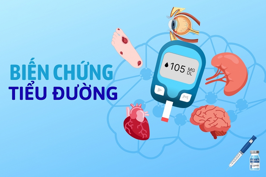 Những biến chứng nguy hiểm của bệnh tiểu đường