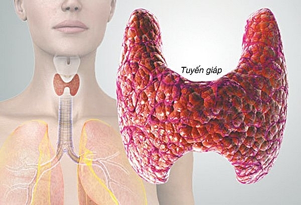 Nguyên nhân, triệu chứng suy tuyến giáp