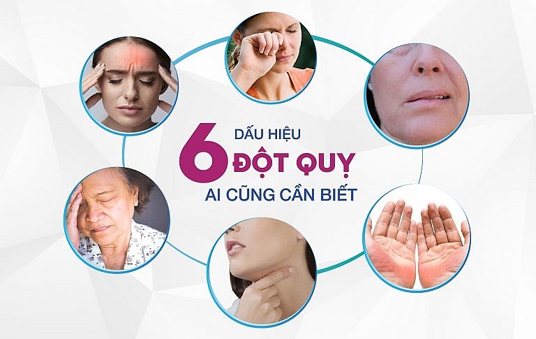 Những dấu hiệu đột qụy nguy hiểm