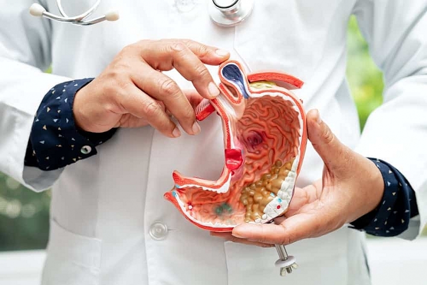 Cách phòng tránh chứng nóng rát dạ dày