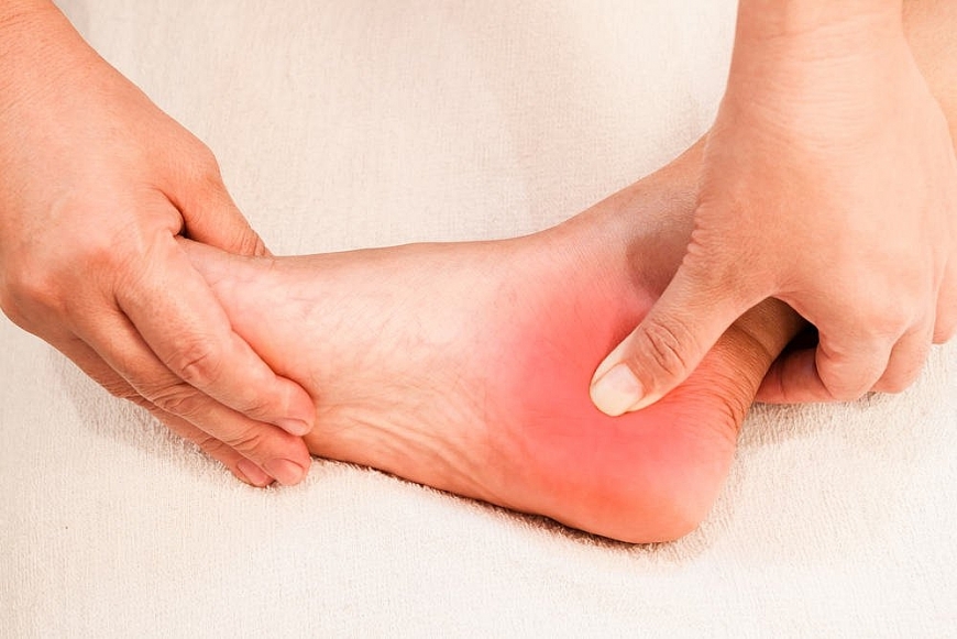 Cảnh giác những dấu hiệu bất thường ở bàn chân