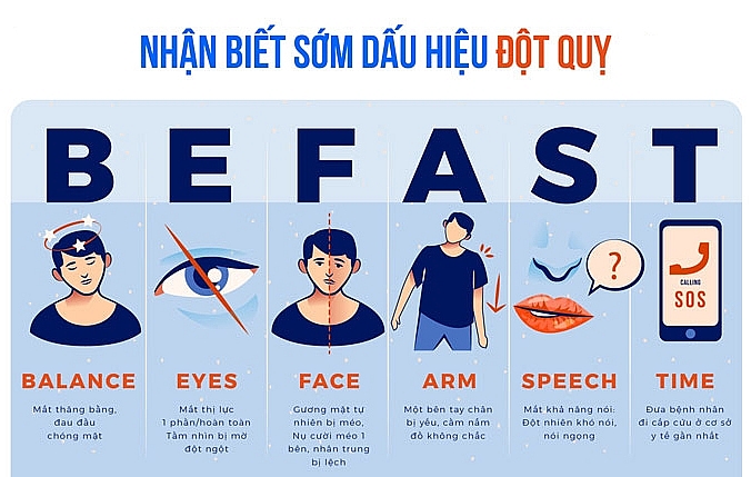 Bệnh nhân đột qụy não cần làm gì để hạn chế tái phát?