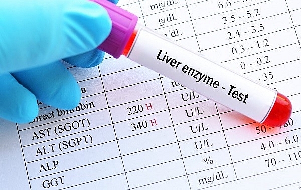Các mức độ men gan tăng cao cần biết