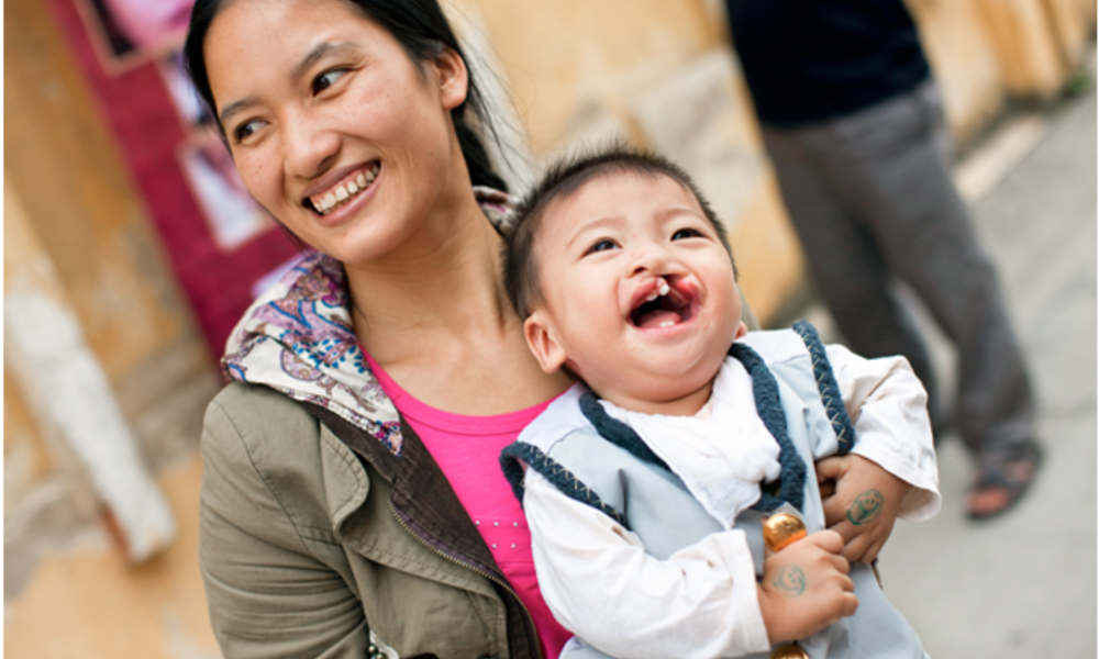 Chung tay góp tiếng cười giúp trẻ hở hàm ếch phẫu thuật.