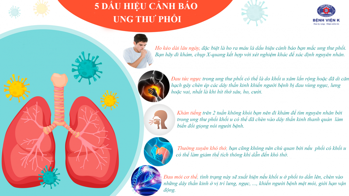 “ Hút thuốc lá” con đường ngắn nhất dẫn đến ung thư phổi