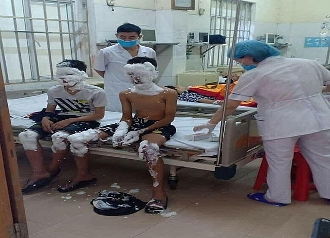 Cuối năm lại lo tai nạn pháo nổ