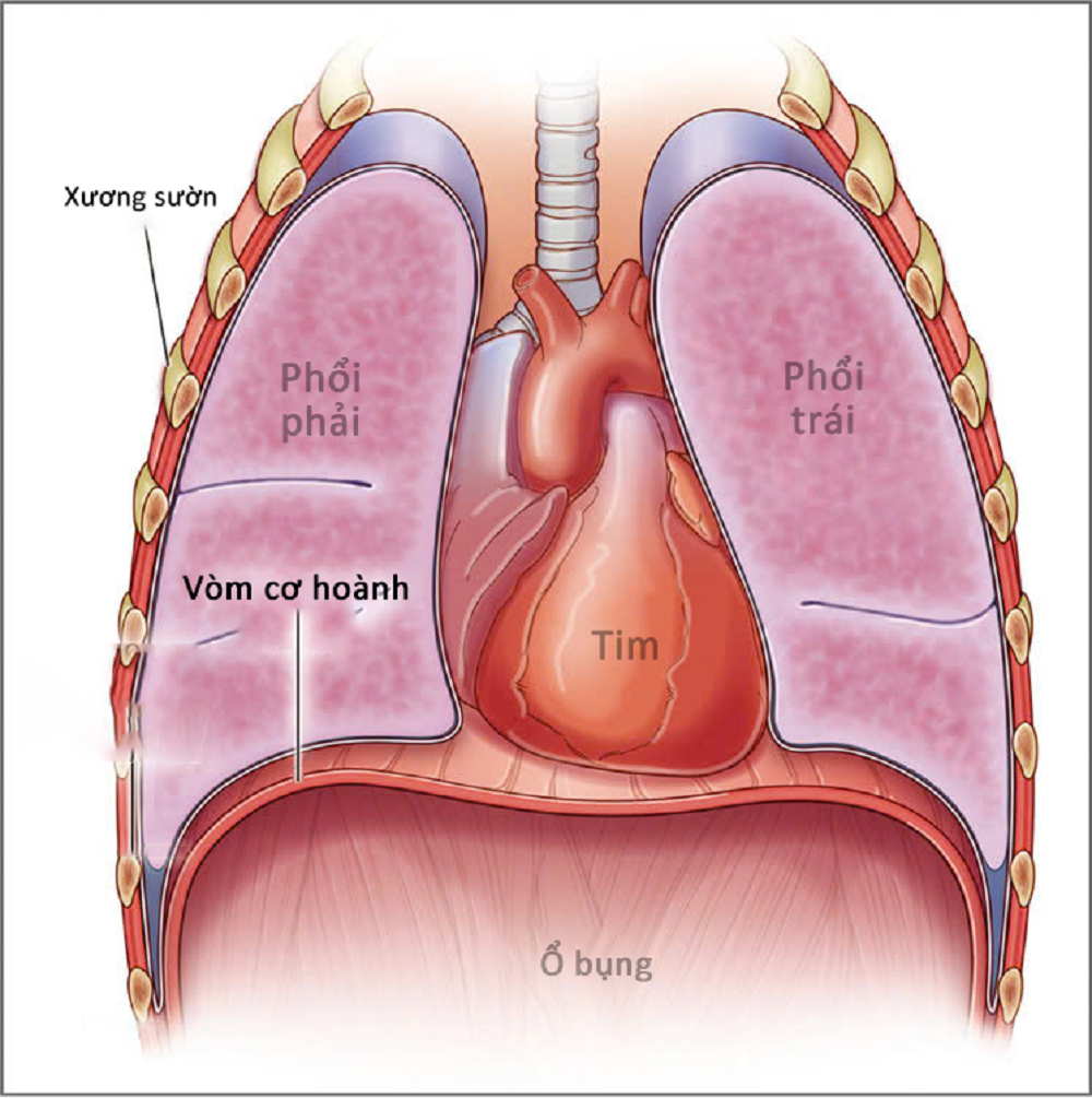 Phẫu thuật robot tạo hình cơ hoành trái cho người bệnh khó thở do nhão hoành