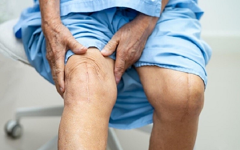 Nguyên nhân và cơ chế gây bệnh xương khớp và rối loạn chuyển hoá ở NCT