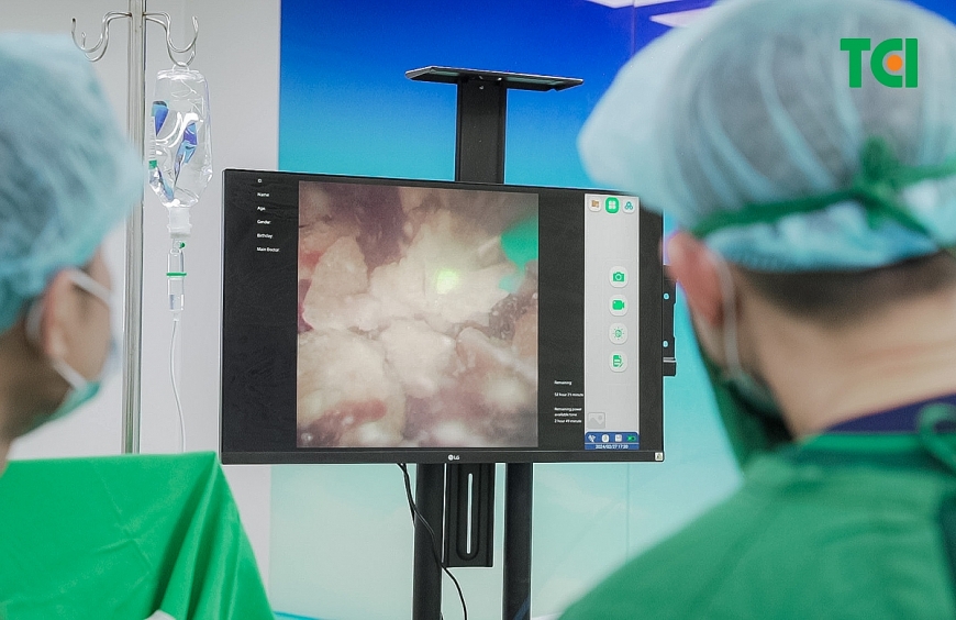 Hình ảnh sỏi được tán vụn dưới năng lượng laser công suất cao (Ảnh: TCI).