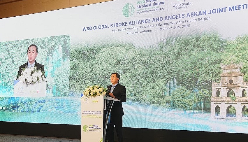 Những bước tiến trong điều trị đột quỵ tại Việt Nam