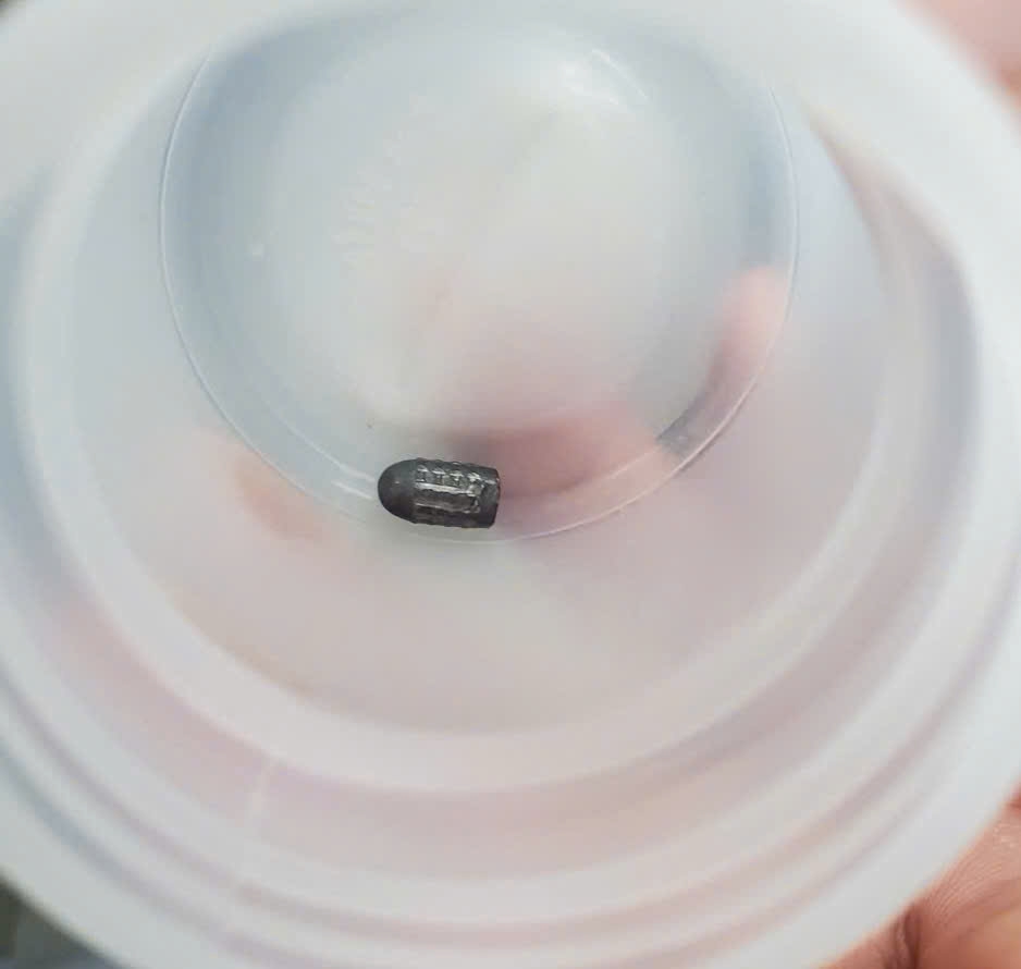 TP. Cần Thơ cứu kịp thời một trường hợp hy hữu