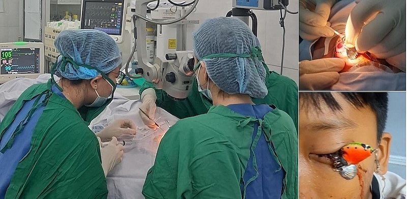Ca phẫu thuật cấp cứu lấy dị vật móc câu cho bé T.T.H (12 tuổi)