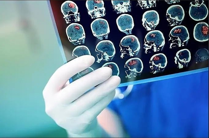 Những người bệnh đái tháo đường, tim mạch, mỡ máu cần đi khám sức khỏe định kỳ để kiểm soát tình trạng bệnh