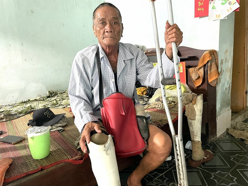 Người cao tuổi bệnh nặng, cụt chân, mưu sinh bằng bán vé số rất cần sự sẻ chia của cộng đồng