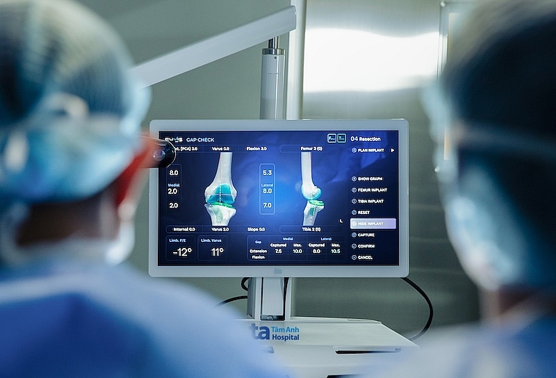 Phần mềm tích hợp AI chuyên dụng của Robot CUVIS-Joint. Ảnh: Bệnh viện Đa khoa Tâm Anh