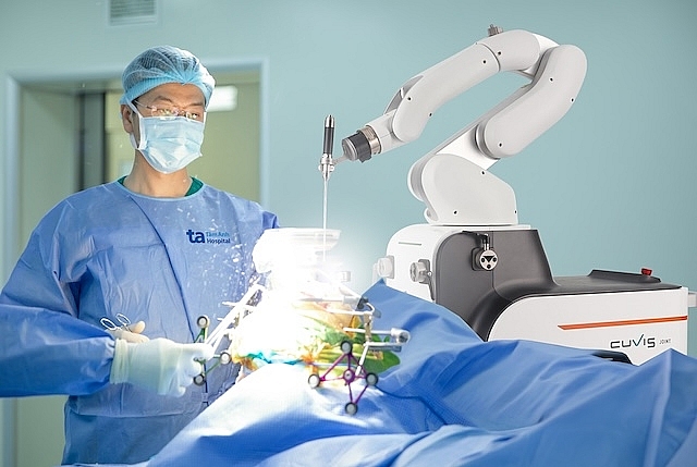 Cánh tay Robot CUVIS-Joint chủ động cắt xương chuẩn xác từng milimet theo kế hoạch. Ảnh: Bệnh viện Đa khoa Tâm Anh