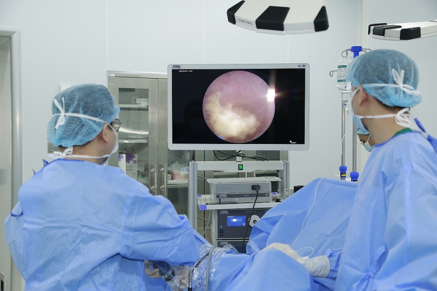 Điều trị sỏi thận hoàn toàn không vết mổ