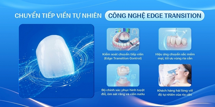 Kathleen: Tiên phong công nghệ răng sứ cao cấp tại Việt Nam