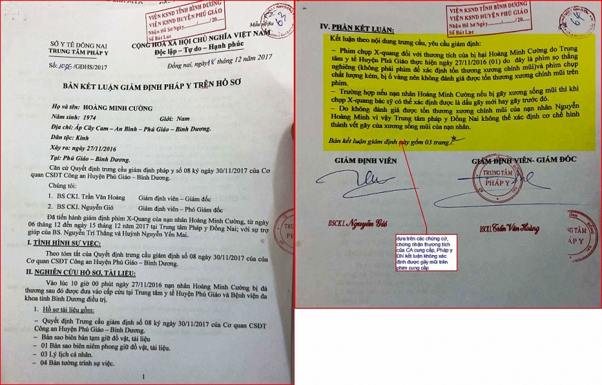 Kết luận ngày 18/12/2017 của Trung tâm Pháp y (Sở Y tế Đồng Nai) nêu rõ: “không thể xác định cơ chế hình thành vết gãy trên sống mũi bệnh nhân”.