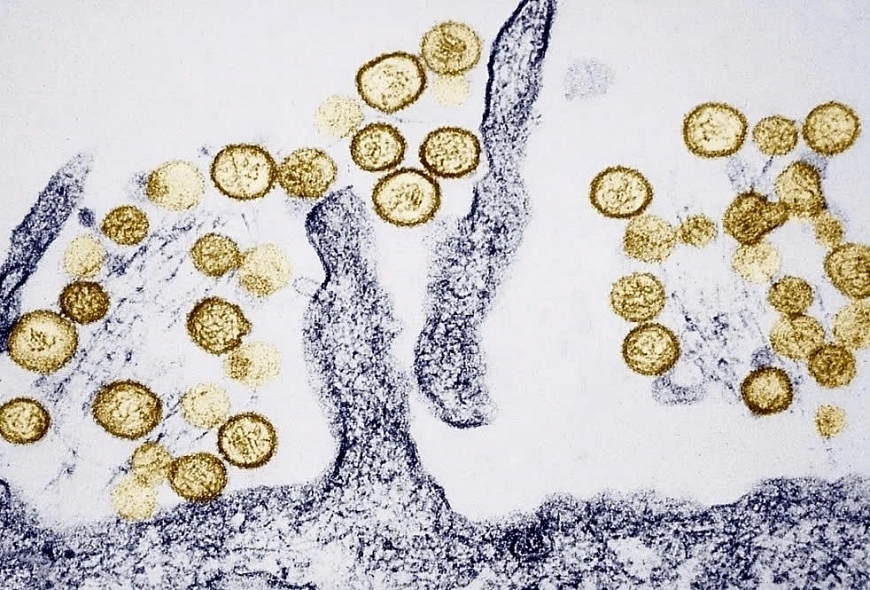 Virus Hanta rất hiếm khi lây từ người sang người - tình trạng này chỉ xảy ra ở virus Andes, chủng virus Hanta được ghi nhận là nguyên nhân gây ra ổ dịch chết người trên tàu MV Hondius. 