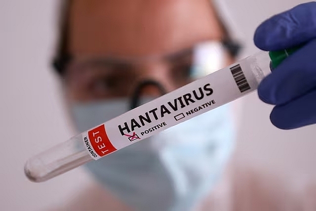 Virus Hanta 