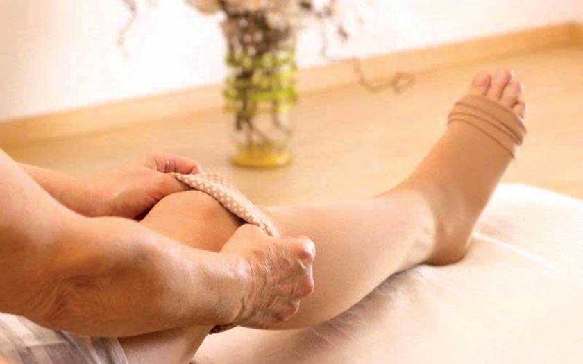 Vớ y khoa: “Trợ thủ” hỗ trợ phòng ngừa và cải thiện suy giãn tĩnh mạch