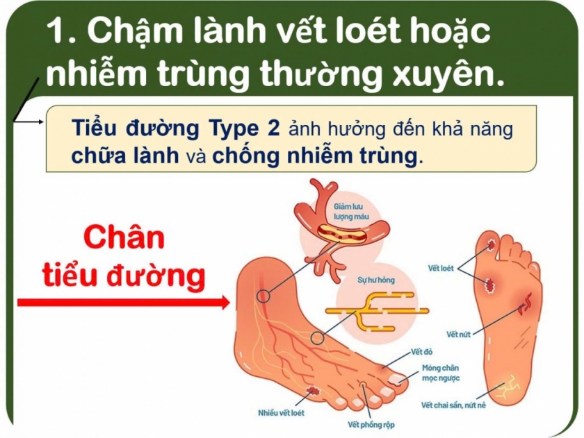 Dấu hiệu cảnh báo bệnh đái tháo đường