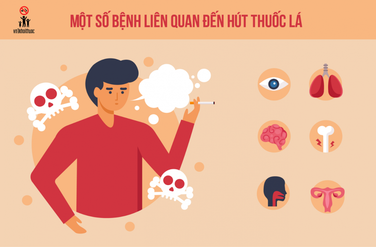 Không để thế hệ trẻ bước vào vòng xoáy nghiện thuốc lá Không để thế hệ trẻ bước vào vòng xoáy nghiện thuốc lá