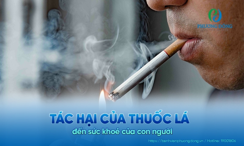 Không để thế hệ trẻ bước vào vòng xoáy nghiện thuốc lá Không để thế hệ trẻ bước vào vòng xoáy nghiện thuốc lá