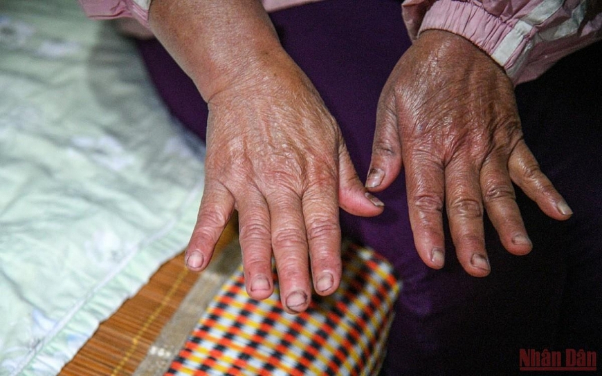 Dân ngụ cư ven sông Hồng chống rét