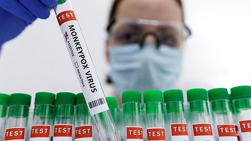 Ống đựng mẫu xét nghiệm dương tính với đậu mùa khỉ. Ảnh: Reuters