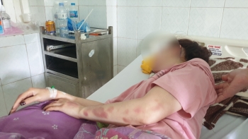 Thanh Hoá: Công an vào cuộc vụ cán bộ QLTT đánh bạn gái trọng thương
