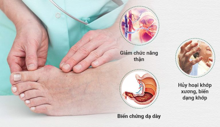 Thực đơn dành cho người bị bệnh Gout