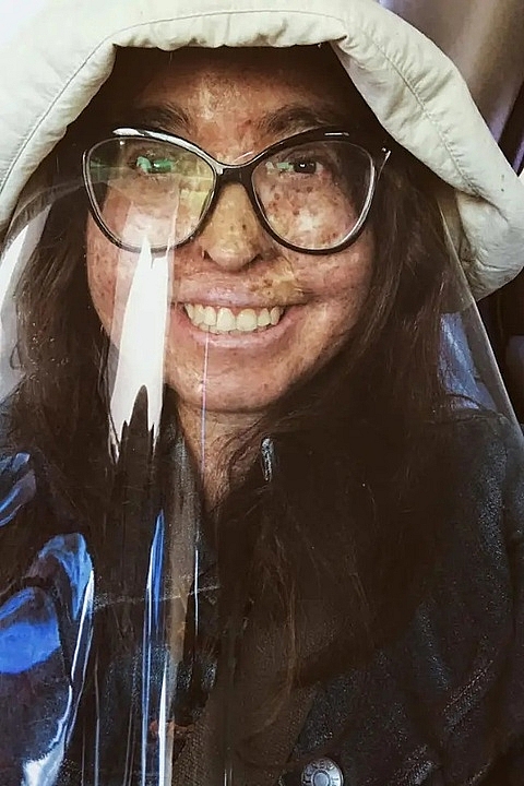 Andrea luôn phải mặc mặc quần áo bảo hộ và mang theo máy đo chỉ số UV ở mọi nơi cô đến