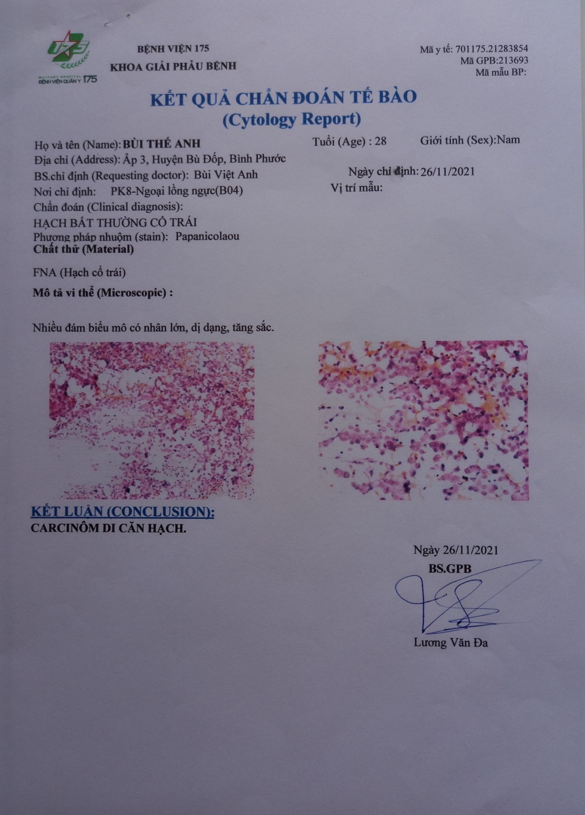 Kết quả chẩn đoán bệnh tế bào của anh Thế Anh