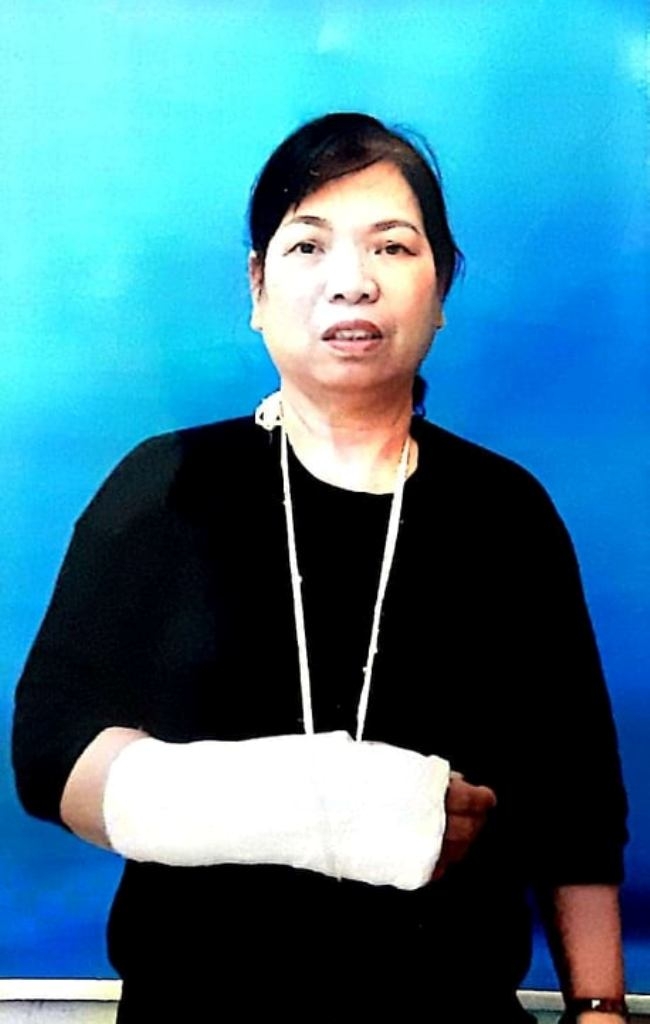 Bà Trần Thị Tiến với thương tích gãy tay được bó bột