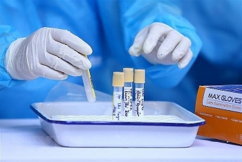 Hà Nội triển khai xét nghiệm SARS-CoV-2 cho hơn 31.000 nhân viên y tế và người bệnh