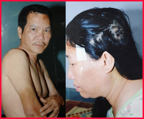 Trở lại bài viết “Xung quanh việc bà Nguyễn Thị Năm, ông Nguyễn Xuân Thanh bị khởi tố về hành vi sử dụng nhiều người uy hiếp tinh thần để chiếm đoạt t