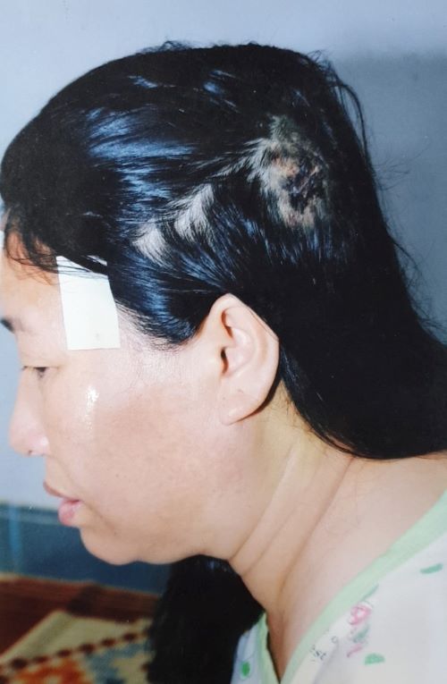 Trở lại bài viết “Xung quanh việc bà Nguyễn Thị Năm, ông Nguyễn Xuân Thanh bị khởi tố về hành vi sử dụng nhiều người uy hiếp tinh thần để chiếm đoạt t