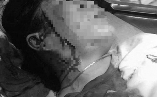 Nổi cơn ghen, người phụ nữ đâm rách mặt tình địch