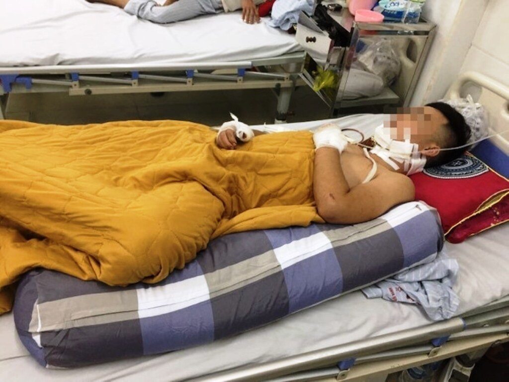 Nghệ An: Nam thanh niên bị đâm nguy kịch khi đi ăn đêm