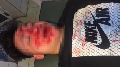 Côn đồ đánh bác sĩ trọng thương tại trung tâm y tế: Triệu tập 7 người