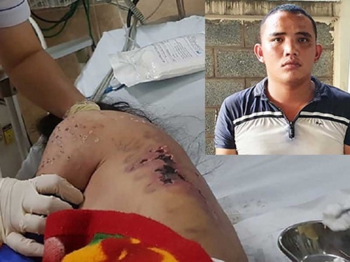 Khởi tố chủ quán cà phê tra tấn nữ tiếp viên vì không chịu kích dục cho khách