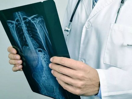 COVID-19: 3 dấu hiệu cho thấy nhiễm trùng đã ảnh hưởng đến phổi