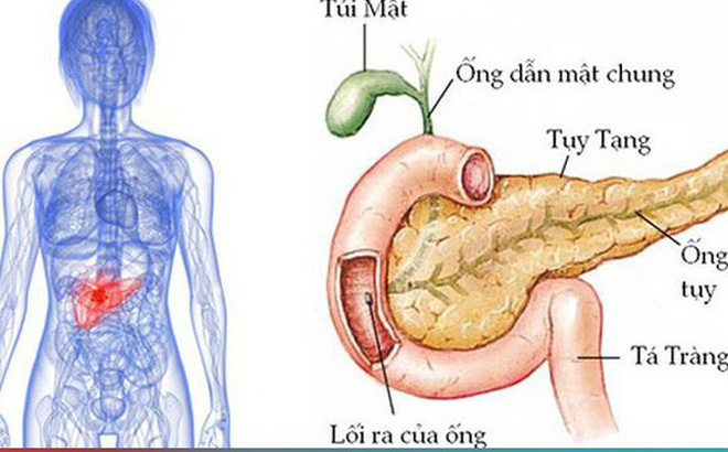 Ung thư tuyến tụy và những triệu chứng dễ bị bỏ qua